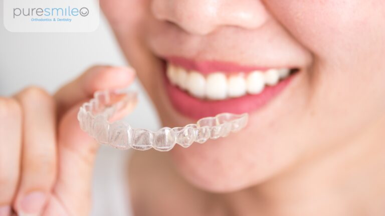 invisalign for adults shanghai