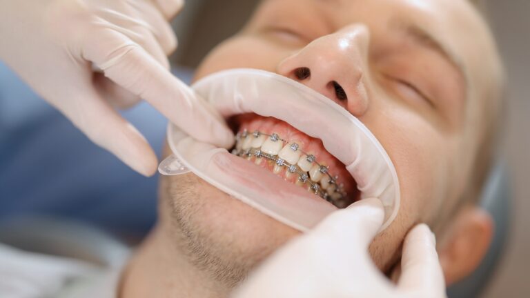 affordable orthodontic treatments in shanghai