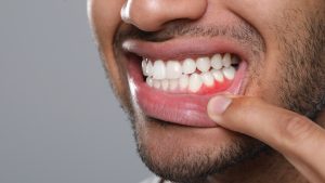 Gum Disease Explained: Stages, Warning Signs, and How to Treat It