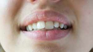 Can Crooked Teeth Cause Jaw Pain? Understanding the Connection