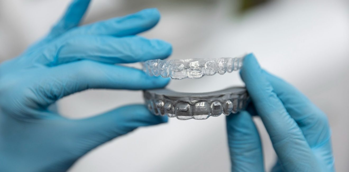 invisalign benefits shanghai