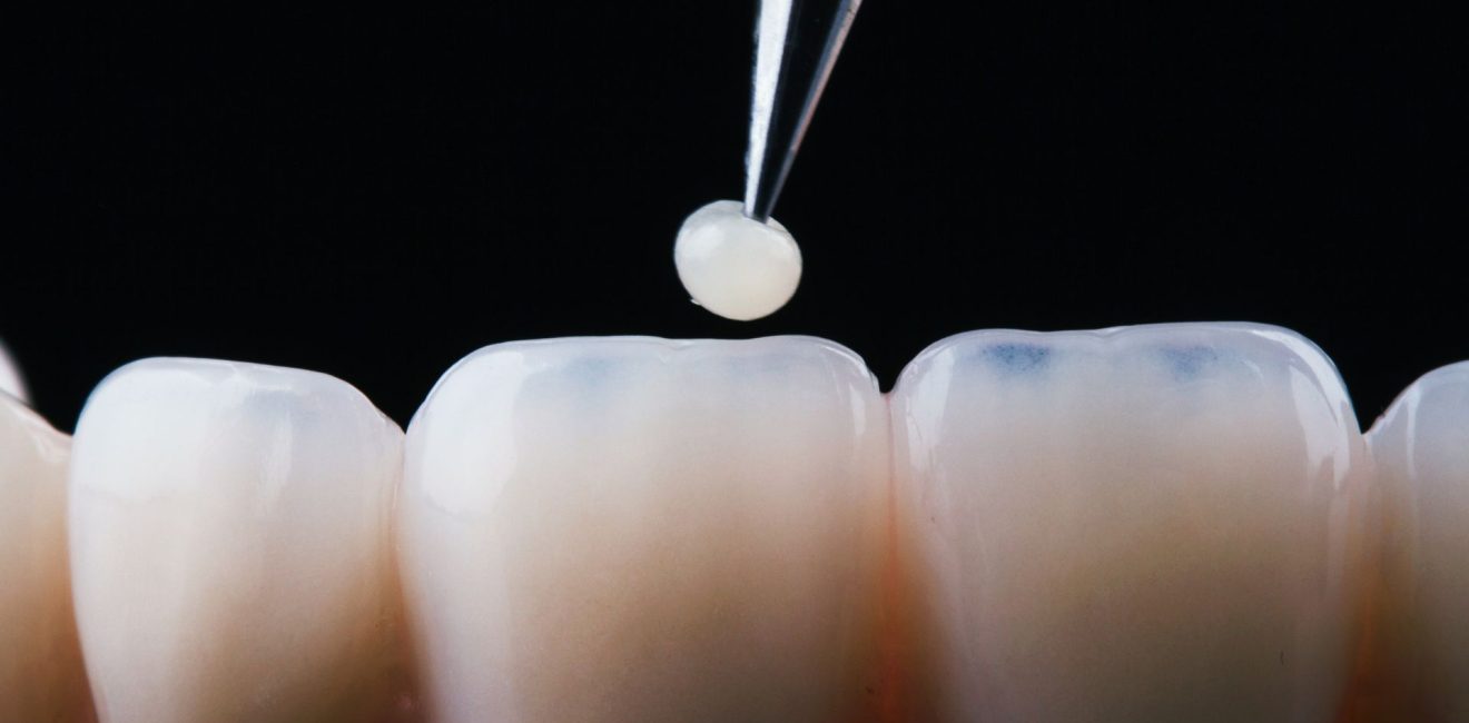 Best Restorative Dentistry Techniques in Shanghai_ Explore Advanced Methods with PureSmile