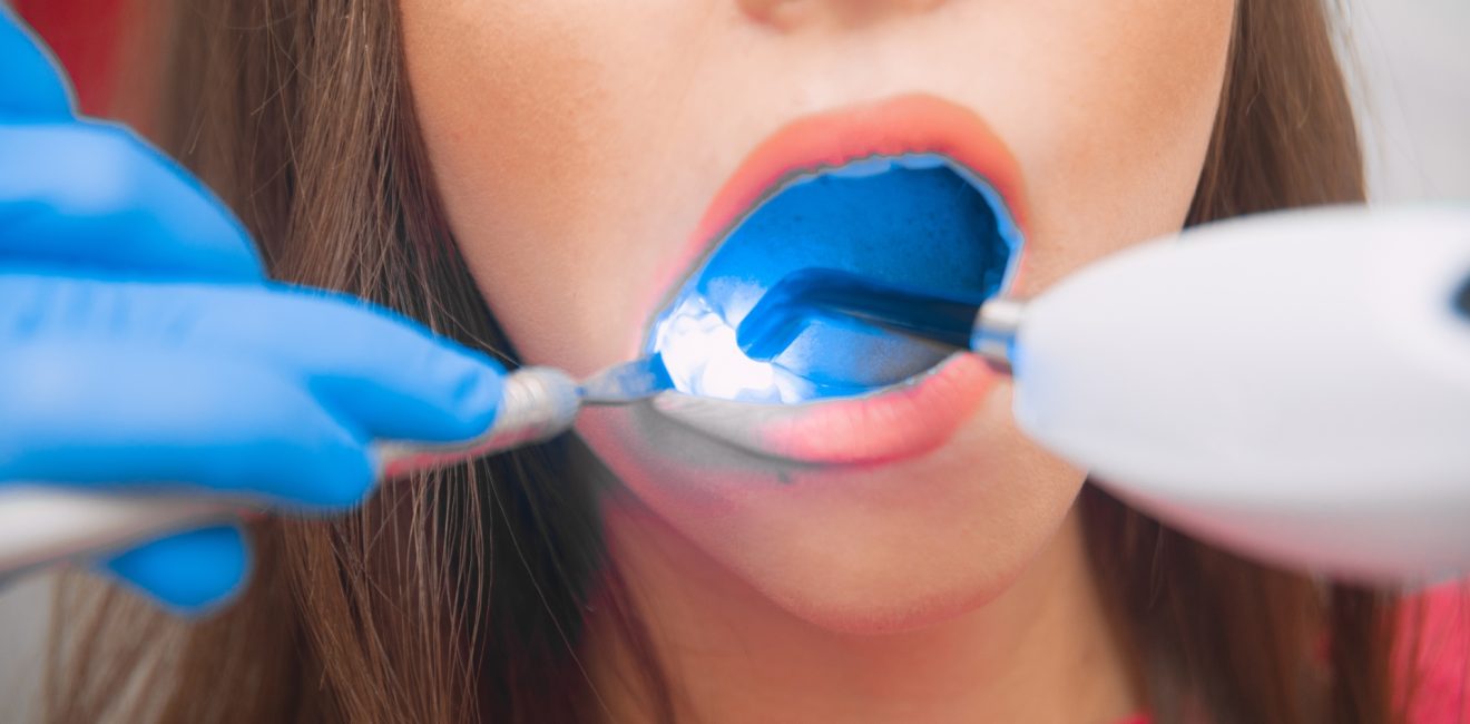 How PureSmile Shanghai Combines the Two for Comprehensive Dental Care