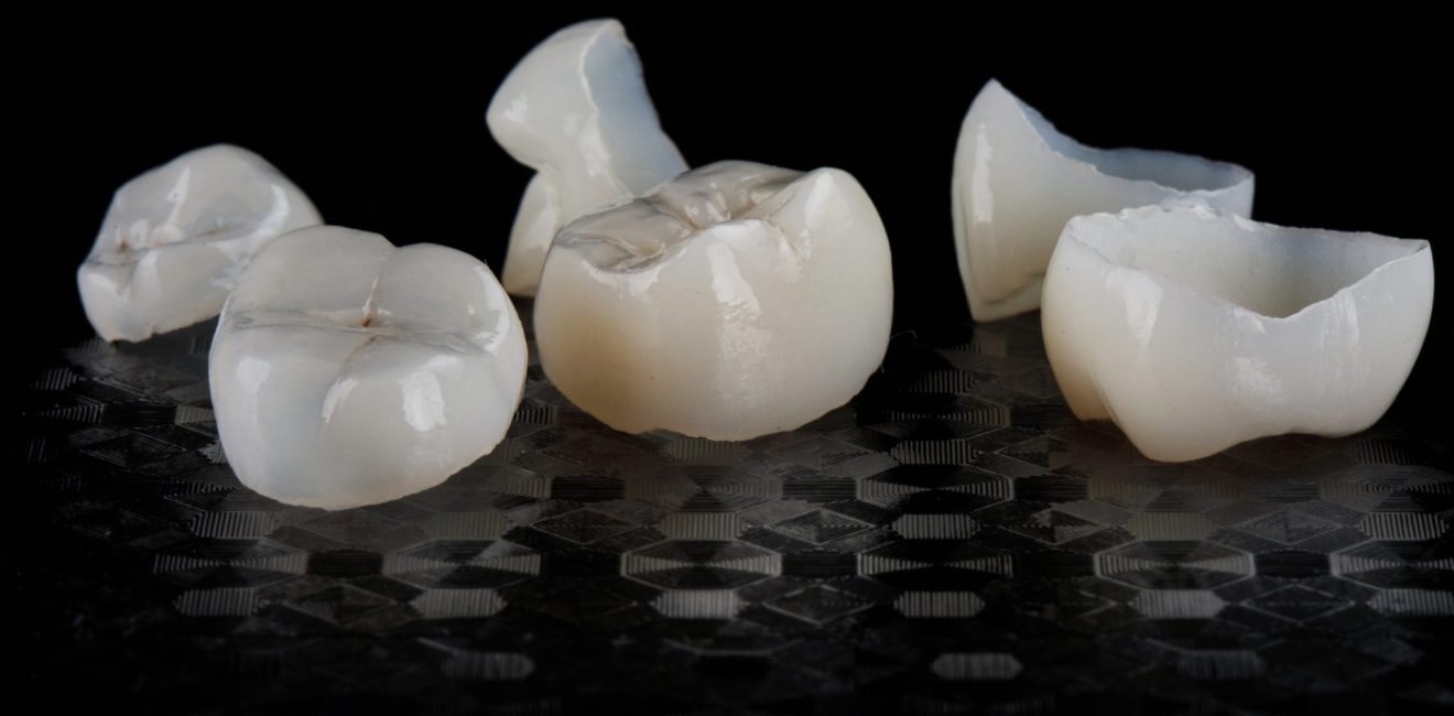 cosmetic dental implants shanghai