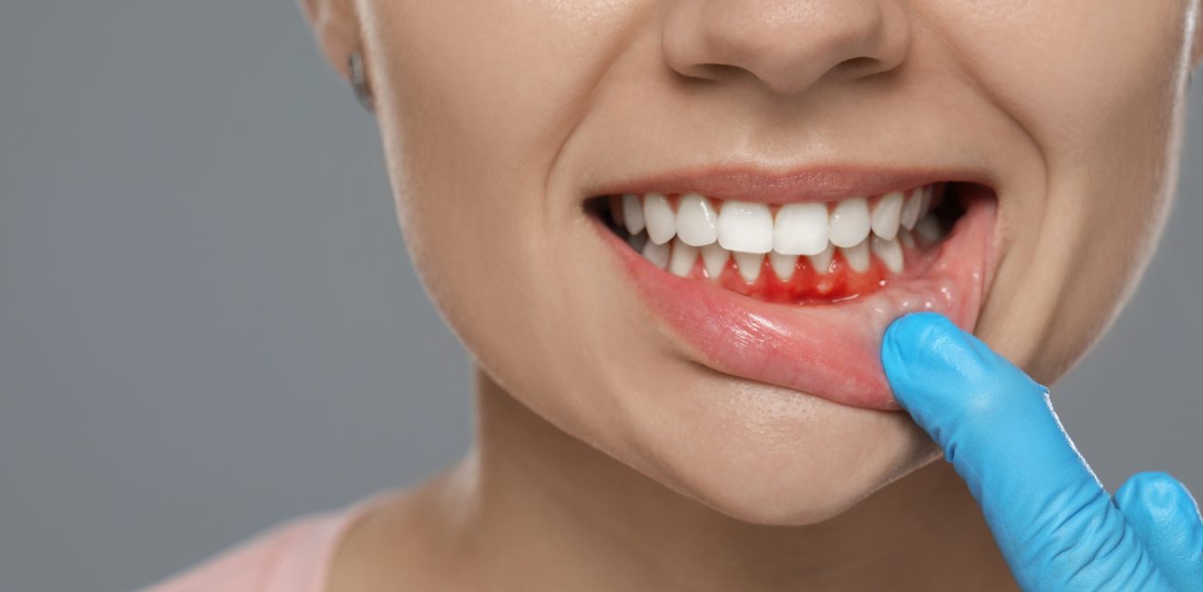 affordable gum disease treatment in shanghai