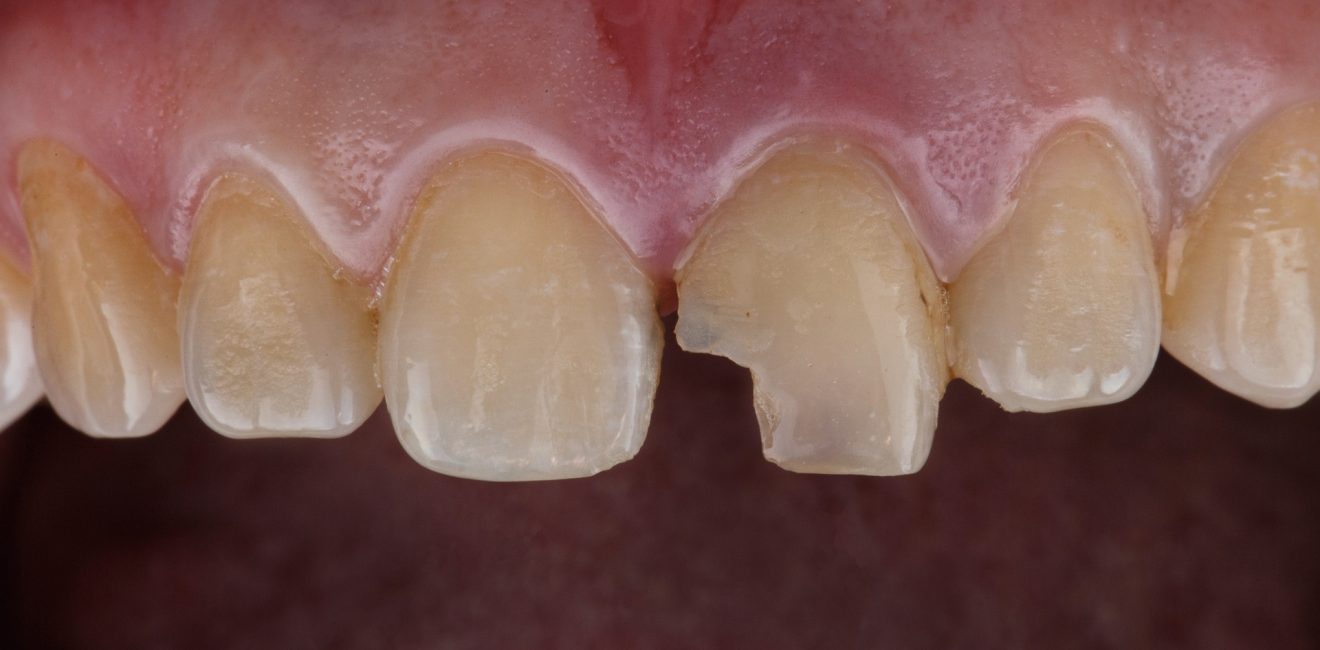 best dental clinic in shanghai