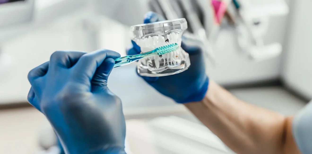 Dentistry. Models of human teeth. Manufacture of dental prostheses. Installation of implants with toothbrush.