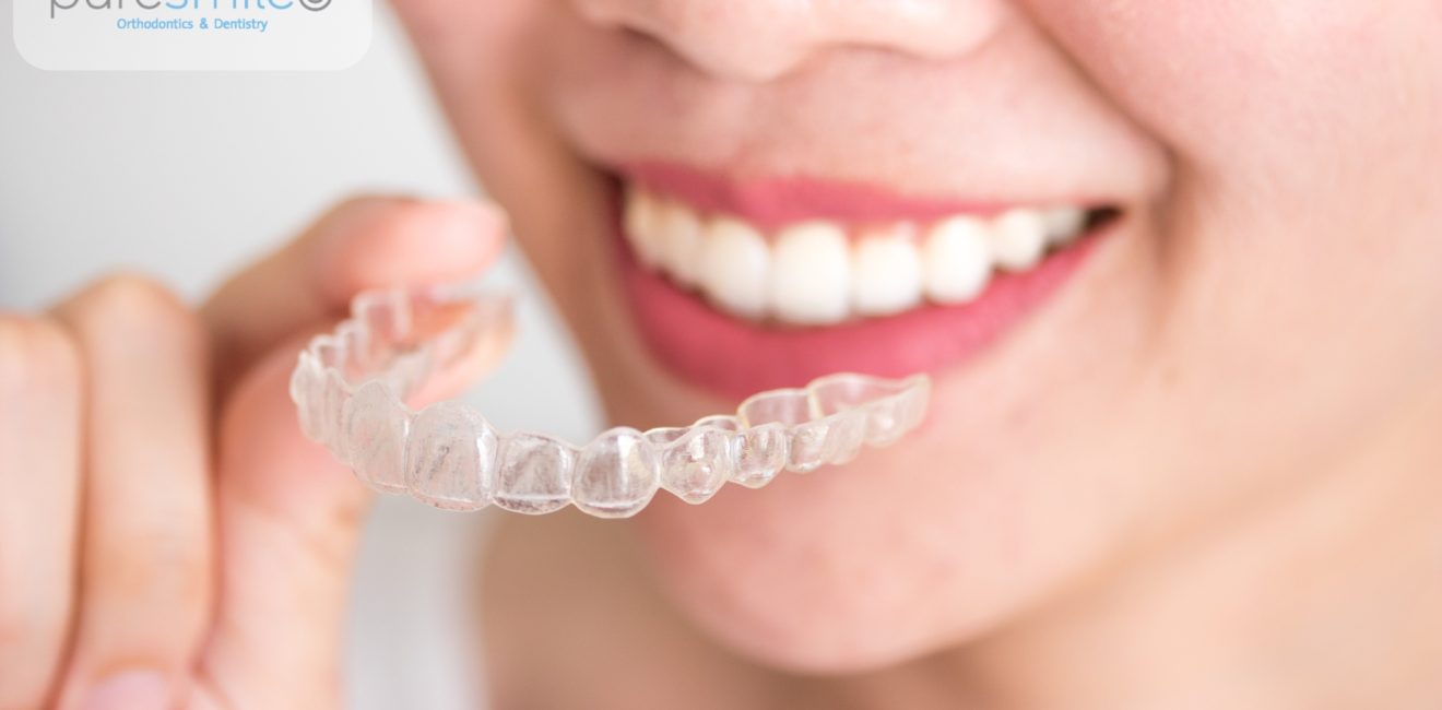 invisalign for adults shanghai