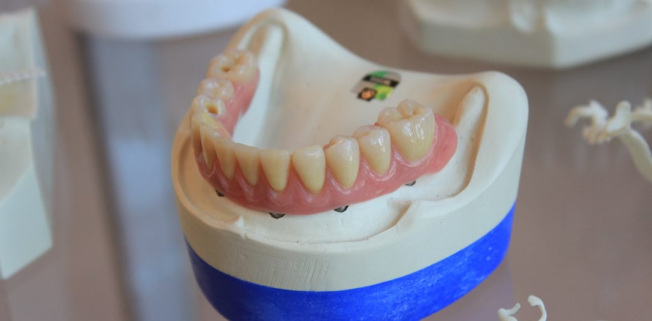 average cost of dental implants