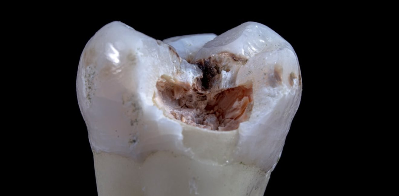 photo-1664530837411-0c2e8a3d4dca