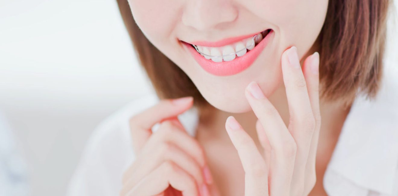 Close up of Beauty woman wear retainer for teeth happily